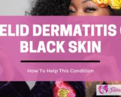 Eyelid Dermatits on Black Skin