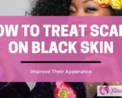 How To Treat Scars On African American Skin