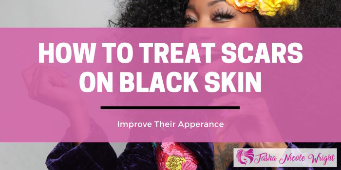 How To Treat Scars On African American Skin